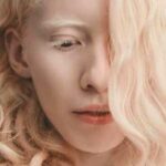 albinos famosos