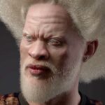 albinos famosos