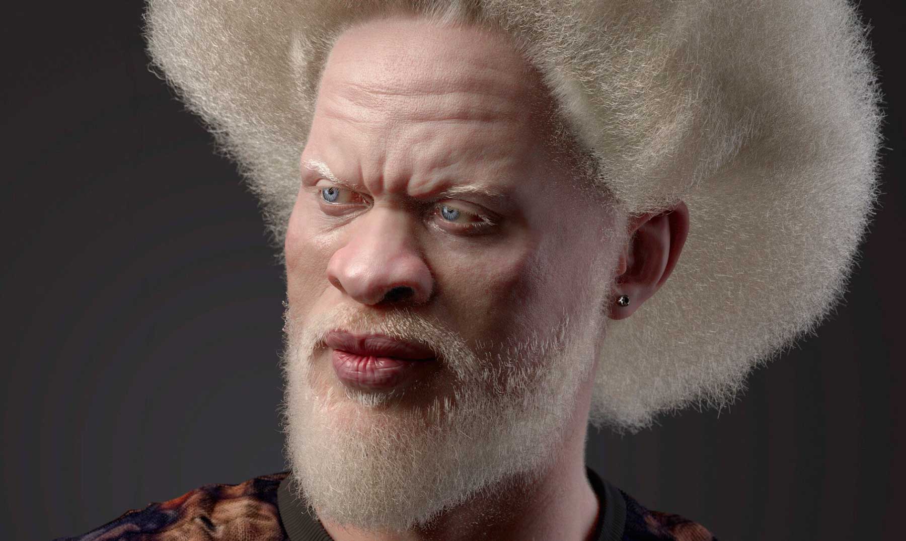 7 Albinos famosos | Los logros detrás de su apariencia