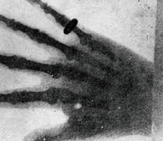 primera radiografía de la historia