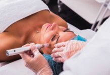 trasplante-capilar-y-tratamiento-para-la-hiperhidrosis-capilar